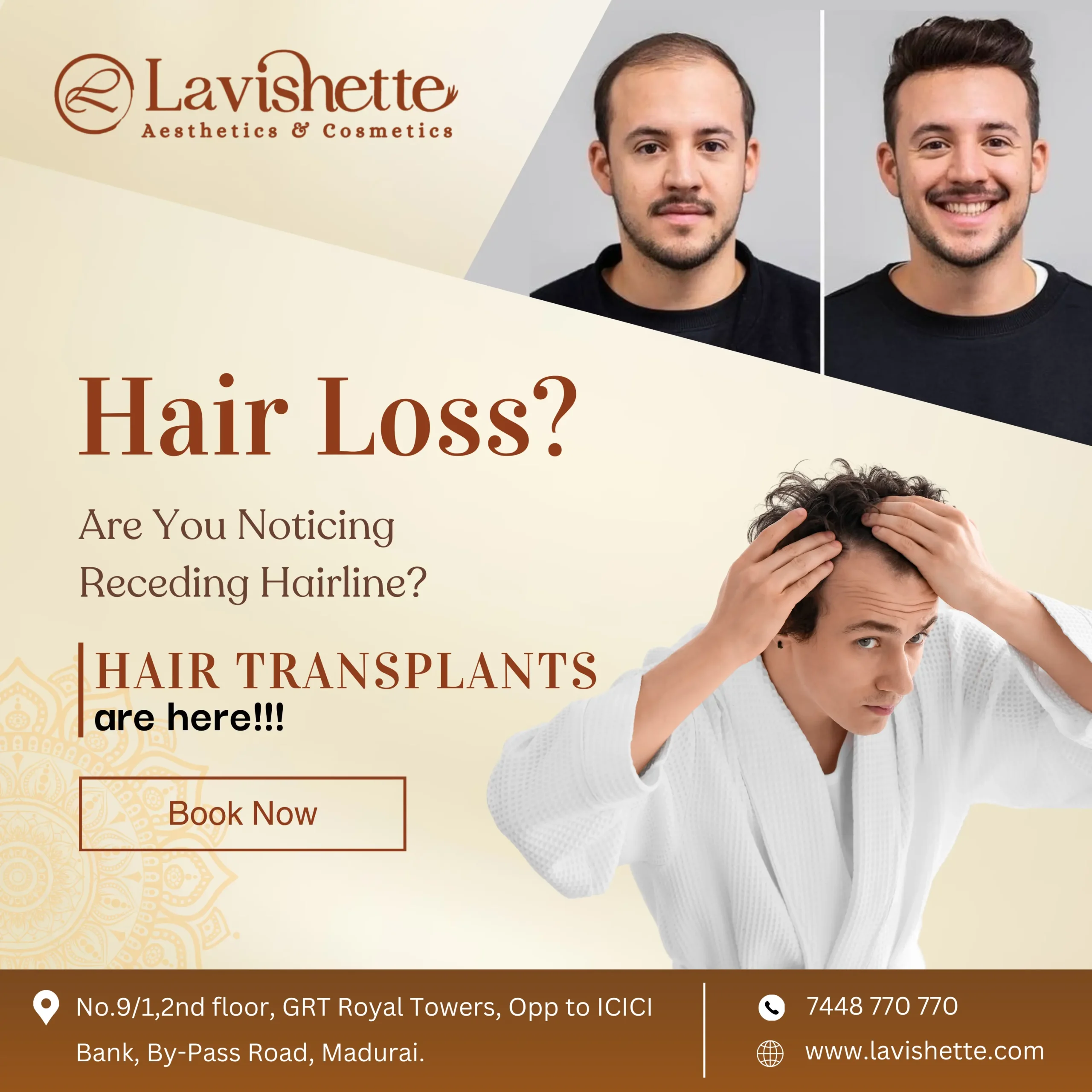 Hair Transplantation 2